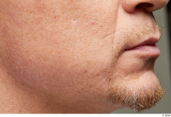 Face Mouth Cheek Skin Man White Scar Bearded Studio photo references